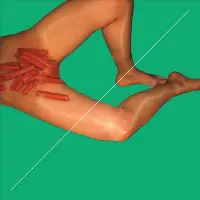 Kartel Creative Rub Remixed