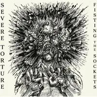 Ginza.se Severe Torture - Fisting The Sockets