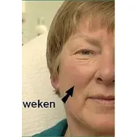 Solutions Cosmeceuticals Solutions Capillary Stop Crème